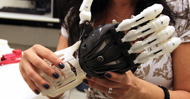 Prótese de mão produzida em uma impressora 3D